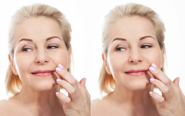 Middle Age Close Woman Face Cosmetic Procedures Skin Care Wrinkled — Stock Photo, Image