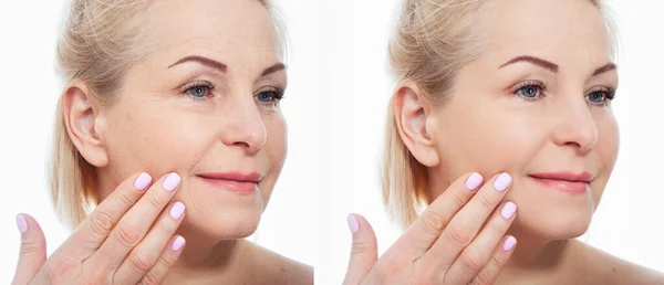 Nahaufnahme Von Frauen Mittleren Alters Vor Kosmetischen Eingriffen Hautpflege Für — Stockfoto