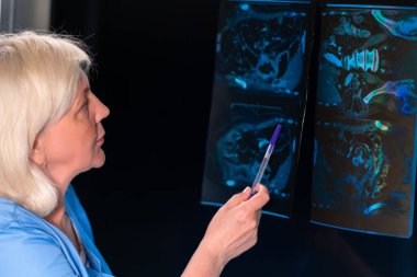 Bir kadın doktor, iç organların röntgenini inceler..