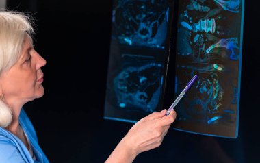 Doktor üniformalı bir kadın röntgene işaret ediyor..