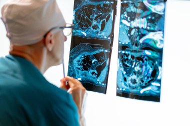 Doktor, monitörüne yerleştirilen iç organların fotoğrafına özenle bakıyor. Resme odaklan..