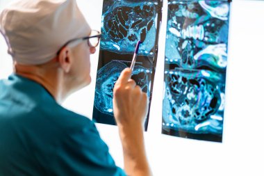 Doktor hastanın durumunu analiz etmek için MR sonuçlarına bakıyor..