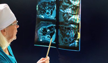 Ofisinde röntgen görüntülü bir monitörle çalışan bir radyolog..