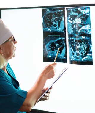 Doktor röntgen görüntülerini incelerken test sonuçlarını kaydeder..