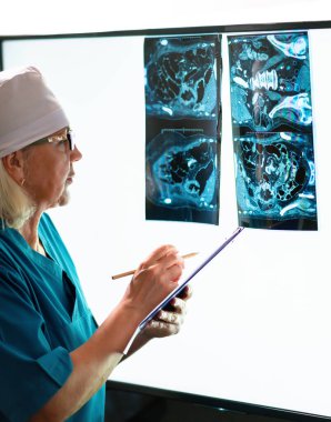 Doktor röntgen görüntülerini incelerken testlerin sonuçlarını kaydeder..