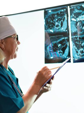 Doktor röntgen görüntülerini incelerken test sonuçlarını not alıyor..