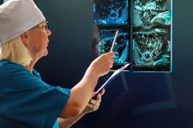 Doktor röntgen görüntülerini incelerken testlerin sonuçlarını tutuyor..