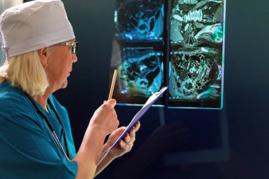 Test sonuçları röntgen görüntülerini inceleyen bir doktor tarafından kaydedilir..