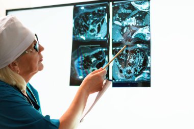 Doktor röntgen görüntülerini inceler ve test sonuçlarını kaydeder..