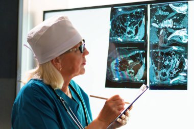 Kadın bir doktor hastanın tıbbi test sonuçlarını takip eder..