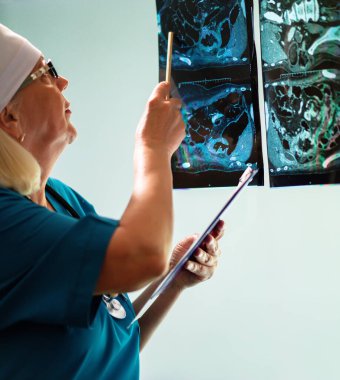 Hastanın tıbbi test sonuçları bir kadın doktor tarafından izlenir..