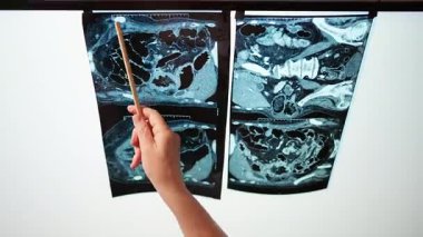 Resimlere bakan bir doktorun eliyle Negaatoskop ekranının üst görüntüsü.