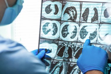 Doktor hastanede kafa MRI görüntüsünü inceliyor..