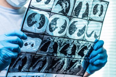 Doktor hastanın MRI tarama dikkatle inceliyor