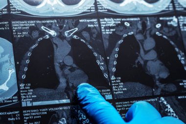 Doktor hastanın MRI tarama dikkatle inceliyor