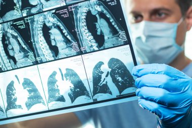 Doktor hastanede kafa MRI görüntüsünü inceliyor..