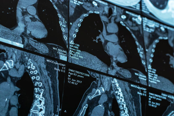 Close up of a body CT scan background.