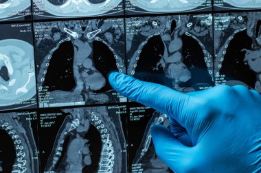 Doktor hastanın MRI tarama dikkatle inceliyor