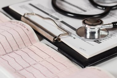 Steteskop kalp atışı grafiğinde ve tıbbi boşlukta. Sağlık hizmetleri kavramı.