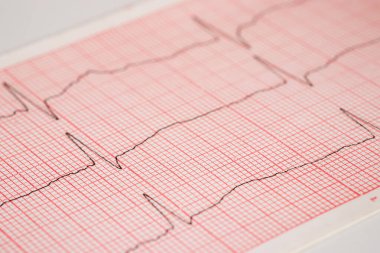 Kalp ritmi ekokardiyogramı. Doktorlar bunu kalp hastalıkları tedavilerini analiz etmek için kullanıyor.