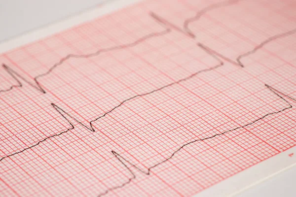 Ritmo Cardíaco Ekg Nota Sobre Papel Médicos Usá Para Analisar — Fotografia de Stock