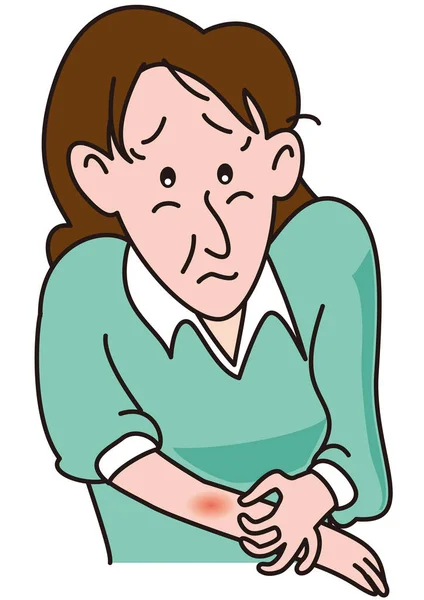 Uma Mulher Meia Idade Com Eczema Braço —  Vetores de Stock