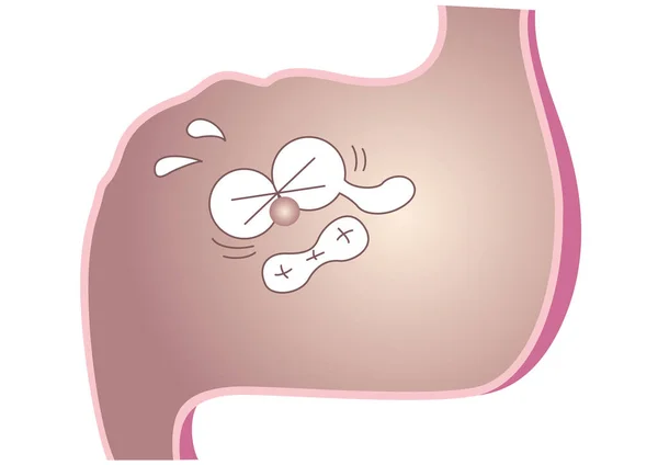 Stomach Hurts Distorts Face — Stock Vector