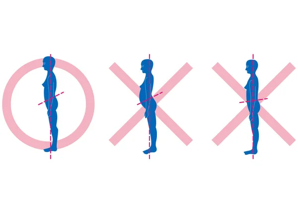 Correct Incorrect Standing Posture — Stock Vector