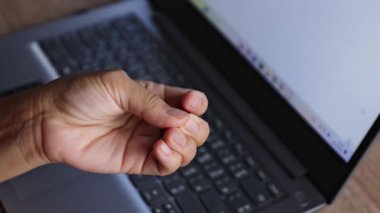 Parmak uçlarında uyuşukluk, arka planda dizüstü bilgisayarla elleri sıkan uyuşuk parmaklar. El uyuşukluğu, sinir ağrısı, karpal tünel sendromu veya aşırı bilgisayar kullanımından kaynaklanan ofis sendromu kavramı.