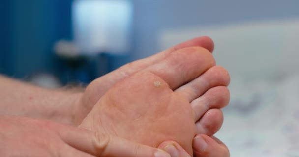 Mann Distanzuntersuchung Fuß Für Warzen Hpv Virus Nahaufnahme — Stockvideo