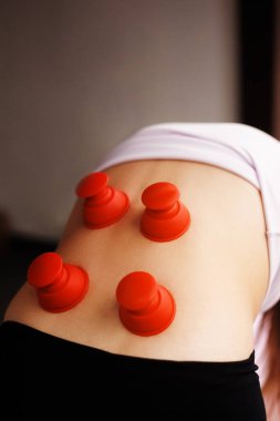 Doktor hastaya vakumlu sırt masajı yapar. Silikon kavanozları. Kadın fizyoterapist erkeklere elektrikli süpürge masajı yapıyor. Lenfatik drenaj, kan akışı. Yukarıdan bak. Yakın plan. Yüksek kalite fotoğraf