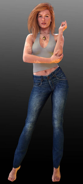 Red Head Woman with Vitiligo wearing a Summer Outfit