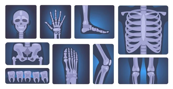 Röntgen Çekimleri Nsan Iskeleti Vücut Parçaları Tıbbi Teşhis Sağlık Konsepti — Stok Vektör