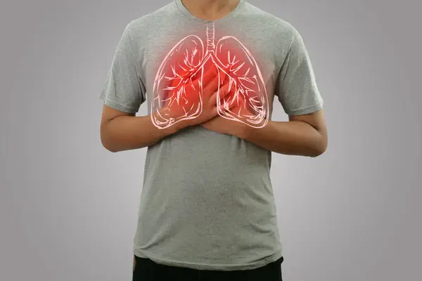 Hombre Sosteniendo Pecho Sintiendo Dolor Con Ilustración Pulmonar Torso Concepto — Foto de Stock