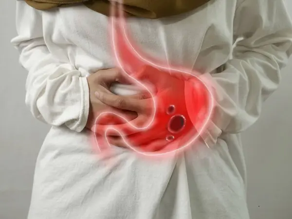 Digitale Zusammensetzung Von Magengeschwüren Bei Kranken Frauen Mit Bauchschmerzen Gesundheit — Stockfoto