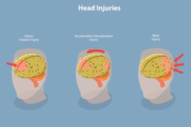 3D Isometric Flat Vector Conceptual Illustration of Brain Injuries, Head Trauma Scheme clipart