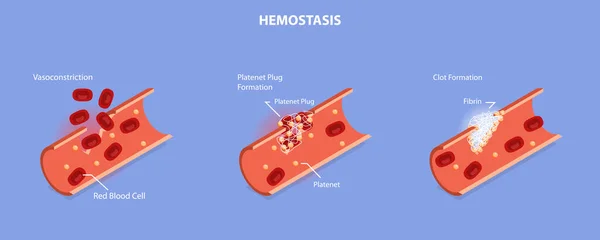 3Dアイソメトリックフラットベクターヘモスタシス 創傷治癒プロセスステージ 血管収縮および血栓形成の概念図 — ストックベクタ