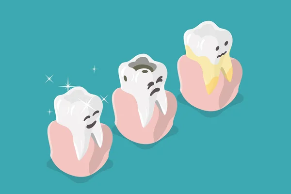 Izometryczne Płaski Wektor Koncepcyjny Ilustracja Próchnicy Zębów Problemy Stomatologiczne — Wektor stockowy