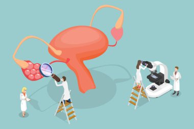 3D Isometric Düz Vektör Polycystic Yumurtalık Sendromu, PCOS Hormonal Teşhis