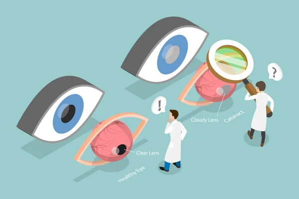 Kataraktın Oftalmolojinin Göz Cerrahisinin Boyutlu Düz Vektör Llüstrasyonu — Stok Vektör