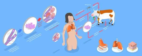 3Dアイソメトリックフラットベクトル 医学感染症サイクルスキームラベル付き炭疽病の概念図 — ストックベクタ
