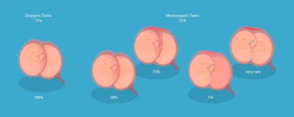 Illustration Conceptuelle Vecteur Plat Isométrique Embryon Dans Utérus Anatomie Abdomen — Image vectorielle