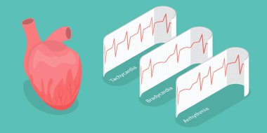 3D Isometric Flat Vector Illustration of Pathological Heart Rhythm Types, Electro-cardiogram clipart