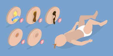 3D Isometric Flat Vector Illustration of Umbilical Cord, After Birth Stages. Swollen, Dry Pus, Scar Tissue, Fall Off clipart