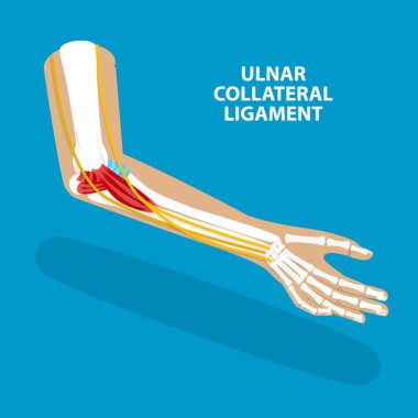 3 Boyutlu Isometric Düz Vektör Ulnar Teminat Bağları, UCL Yapısı