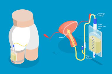 3D Isometric Flat Vector Illustration of Drainage Bladder, Flexible Rubber Urine Bag For Bladder Infections Treatment clipart