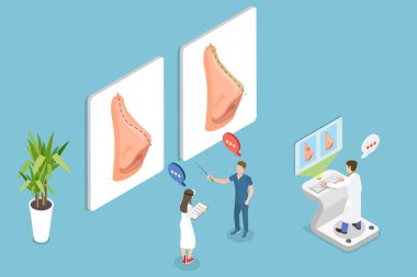 3 Boyutlu Isometric Düz Vektör Burun Büküm Çizimi, Burun Eğri Düzeltme Ameliyatı