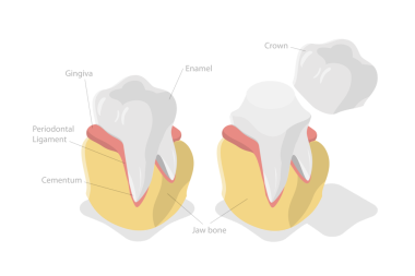 3 Boyutlu Isometric Düz Kavramsal Diş Taç Yenileme, Diş Protezi