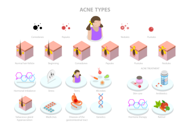 3 Boyutlu Isometric Sivilce Türlerinin Kavramsal Resimleri, Cilt Bakımı