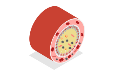 3 Boyutlu Isometric Düz Çölyak Hastalığı, Glüten Hoşgörüsüzlüğü